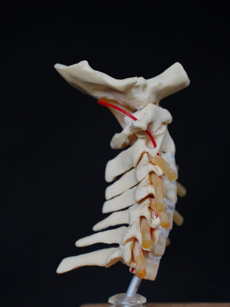 Cervical spine anatomical model with color-coded neurovascular structures, lateral view