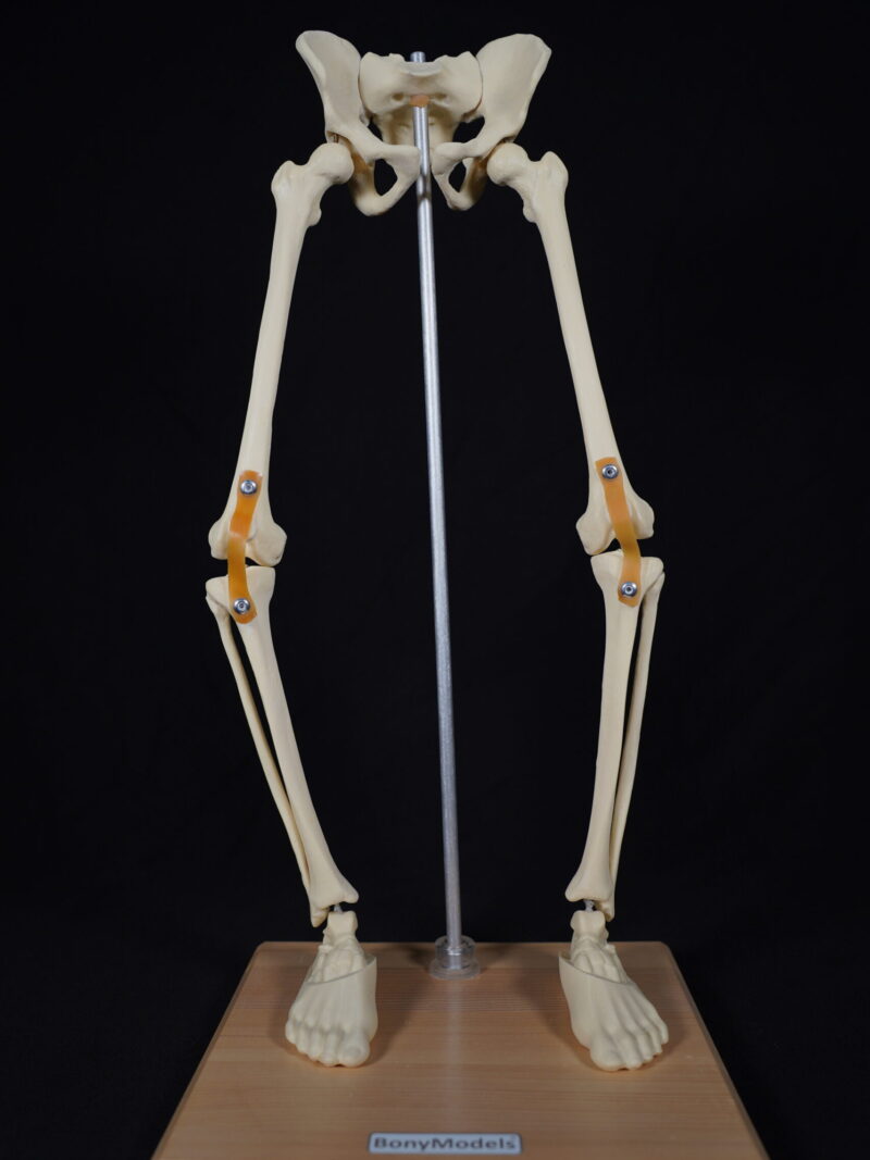 Alt Ekstremite Dizilim Modeli