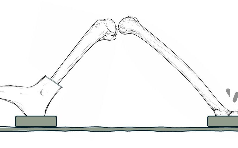 Eksen Knee Holder™ (ÇOK_YAKINDA)