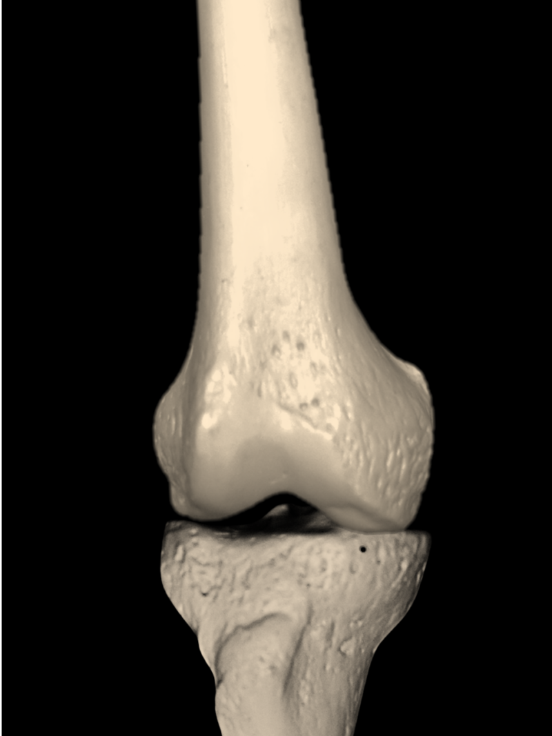 Lower Extremity